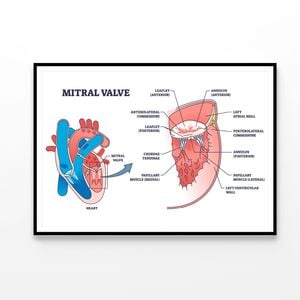 Mitral Valve Structure  Print 100% Australian Made 90x60cm  (Poster)