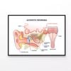 Acoustic Neuroma  Print 100% Australian Made 120x90cm  (Poster)