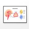 Stress Response System  Print 100% Australian Made 90x60cm  (Poster)