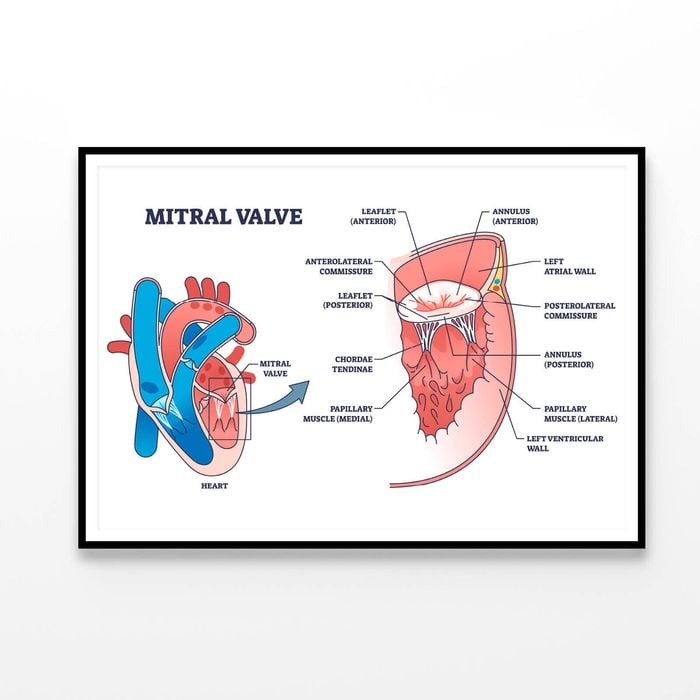 Mitral Valve Structure  Print 100% Australian Made 120x90cm  (Poster)