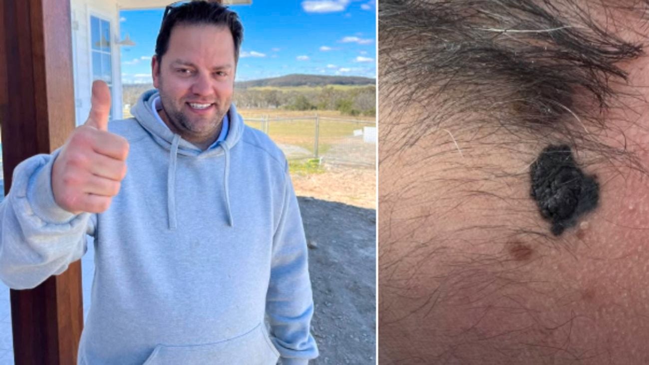 A tradie outdoors giving the thumbs up with a picture of a black mole - melanoma - alongside it.]