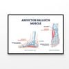 Abductor Hallucis Muscle with Leg  Print 100% Australian Made 90x60cm  (Poster)