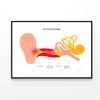 Swimmers Ear Otitis Illustration  Print 100% Australian Made 120x90cm  (Poster)