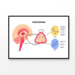 Stress Response System  Print 100% Australian Made 120x90cm  (Poster)