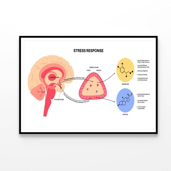 Stress Response System  Print 100% Australian Made 120x90cm  (Poster)